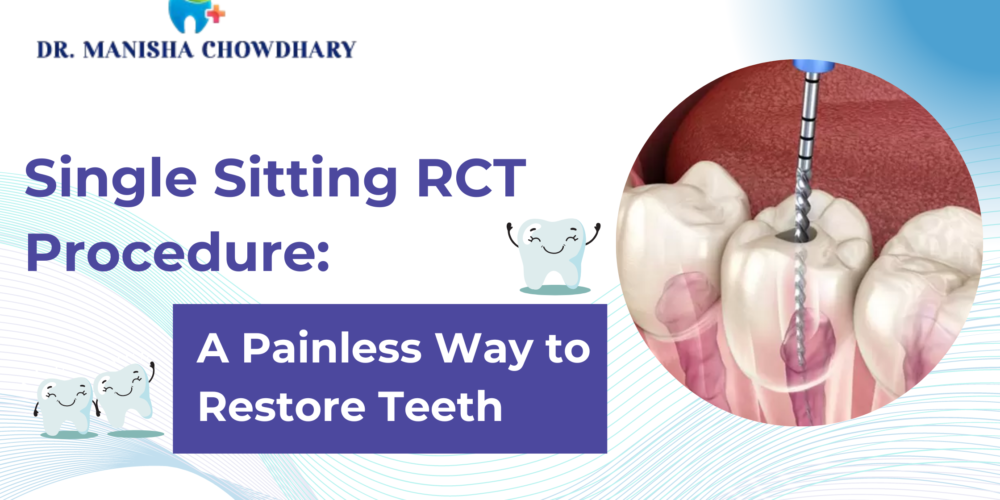 Single Sitting RCT