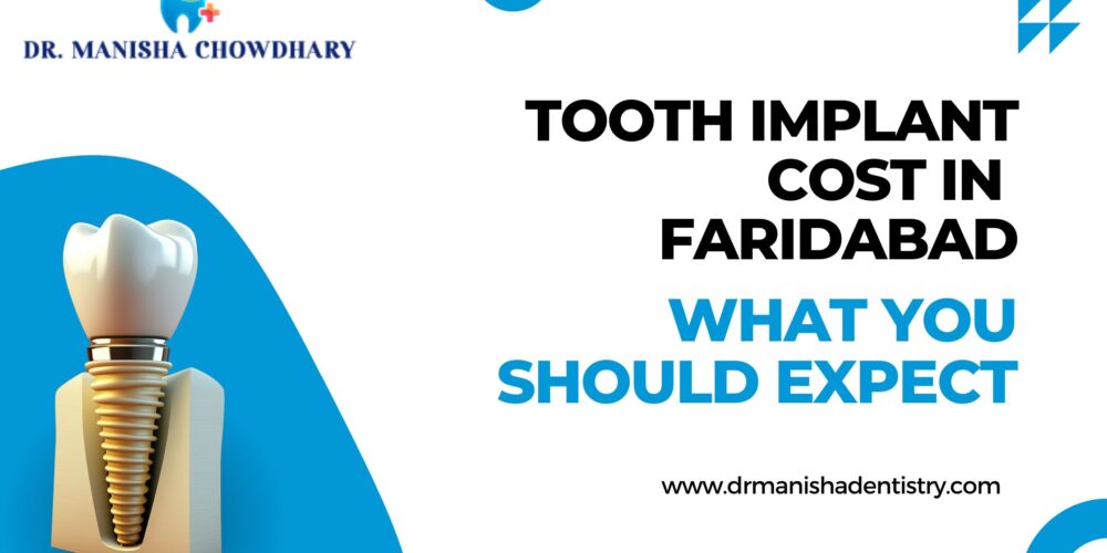 Tooth Implant Cost In Faridabad