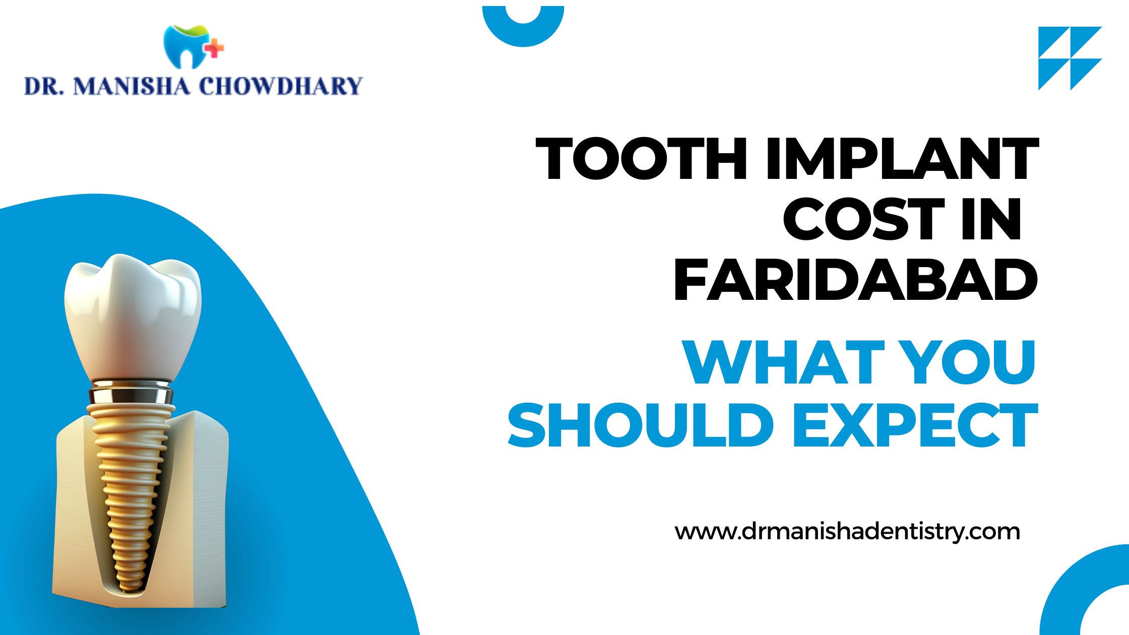 Tooth Implant cost in faridabad