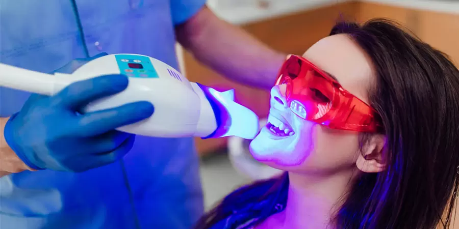 laser-teeth-whitening