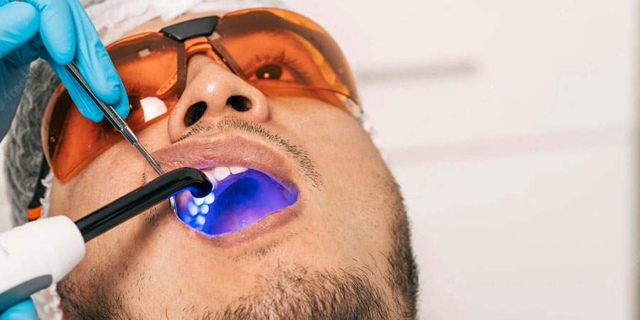 laser-treatment for teeth